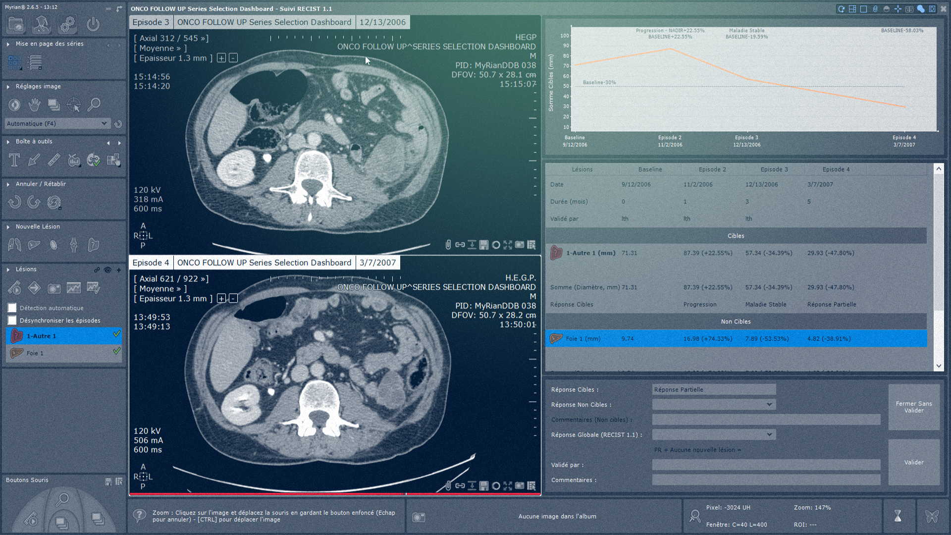Logiciel montrant les images du scanner abdominal - IRM Abdominal - Intrasense - Logiciel Imagerie Médicale, Myrian®
